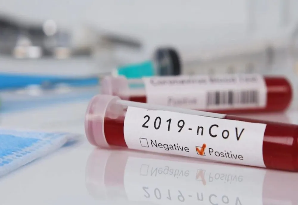Coronavirus România: A crescut numărul celor infectați cu CoVid-19, la 762! Șase pacienți, în stare foarte gravă