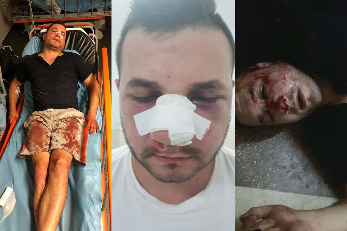 Un tânăr acuză că a fost bătut de un agent în sediul poliţiei timp de două ore şi lăsat să zacă în propriul sânge