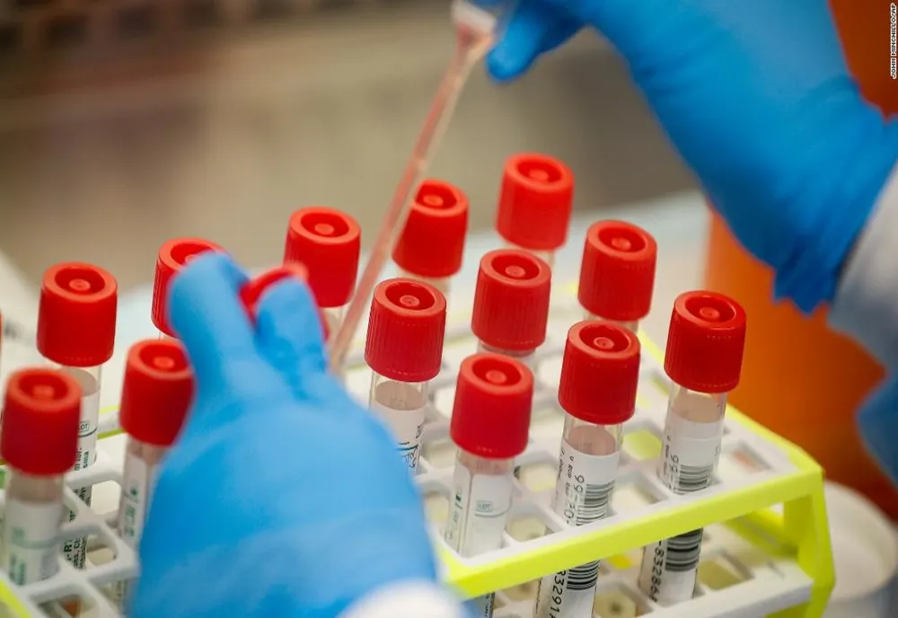 Coronavirus în Tulcea: 212 de teste, 43 de cazuri